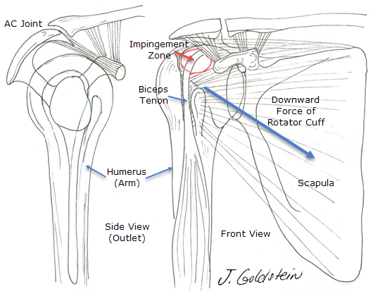 Shoulder Pain Diagnosis Chart, SPORT Orthopedics