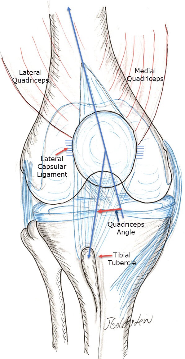 Knee Extensor Realignment Sports Medicine and Orthopedics