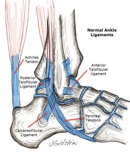 anterior talofibular ligament swelling