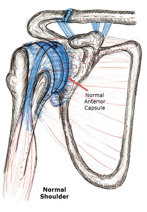 LP 770 Double Full Shoulder Support Dislocated Rotator Cuff Joint